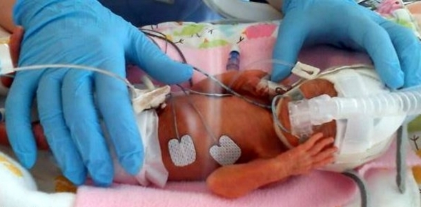 54 gram doğan bebeği buzdolabı poşetiyle hayata döndürdüler