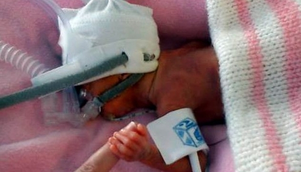 54 gram doğan bebeği buzdolabı poşetiyle hayata döndürdüler